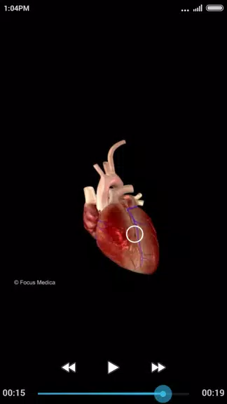 Cardiology-Animated Dictionary Captura de tela 2