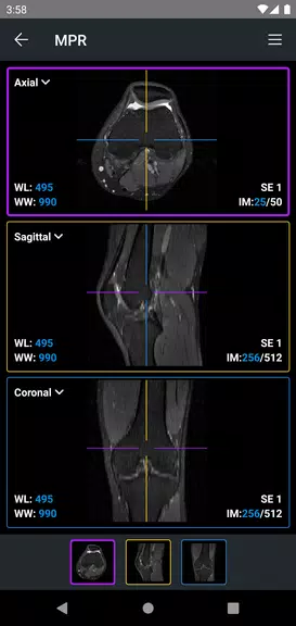 IDV - IMAIOS DICOM Viewer 스크린샷 3