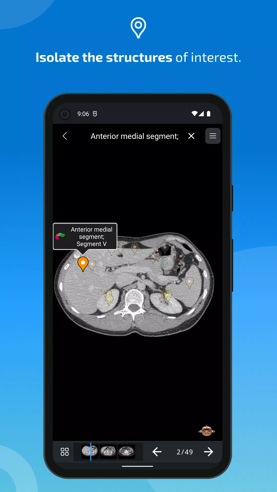 e-Anatomy 螢幕截圖 3